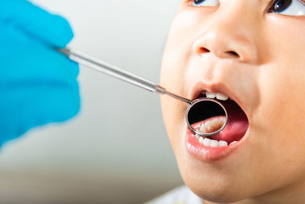 Dental Sealants For Kids In Maryville, TN